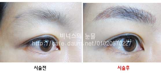 예뿐눈썹 이미지