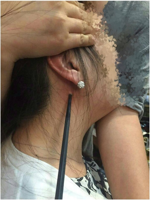 젓가락 사건.jpg | 인스티즈