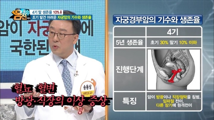 자궁경부암 실제사진.jpg (사진주의) | 인스티즈