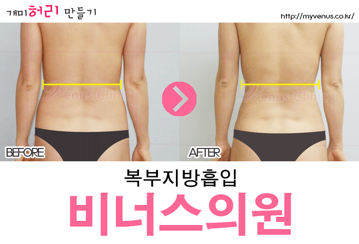 비너스의원 이미지