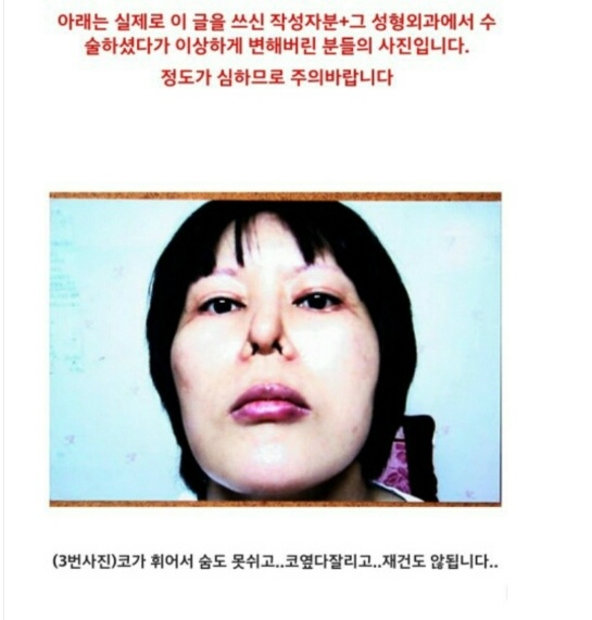 아래 글 사이코패스의사 성형 피해자들 사진 (심약자 주의!) | 인스티즈