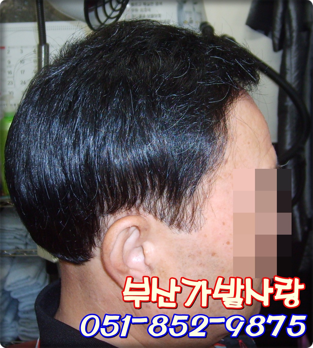가발박사 이미지