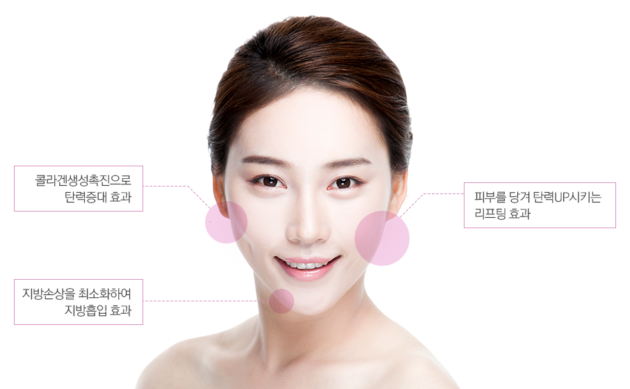 알와이비 이미지