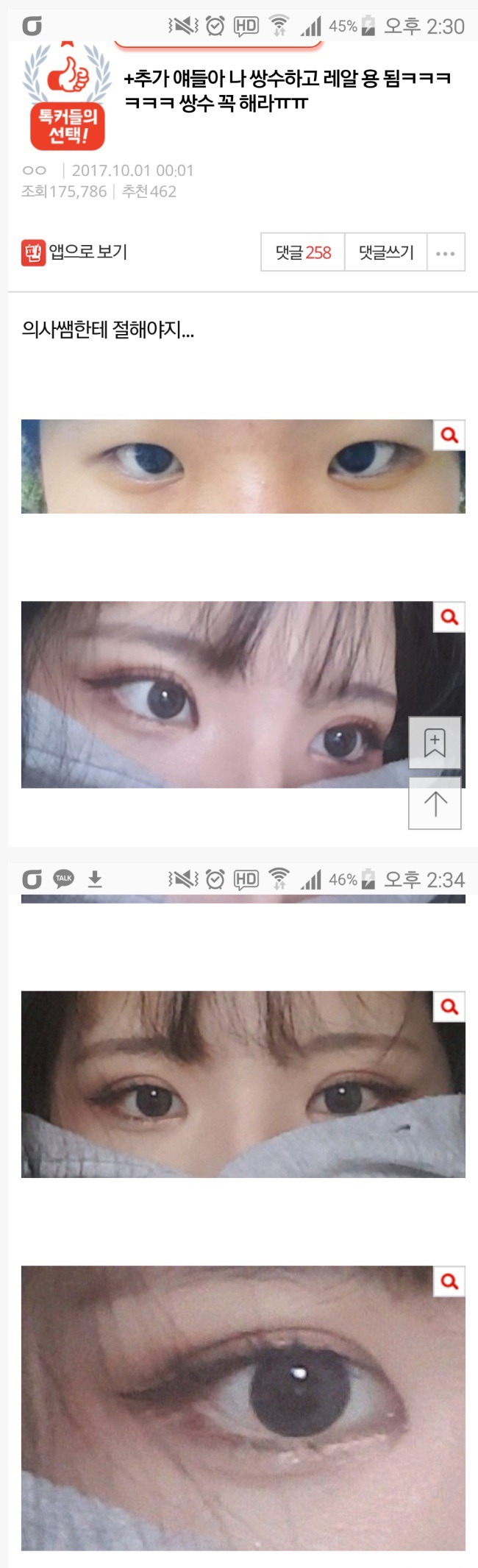 눈 성형의 위엄 | 인스티즈