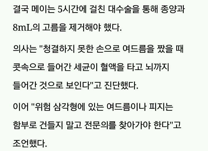 '위험 삼각형' 부분에 난 '블랙헤드' 짰다가 뇌종양 생긴 10세 소녀 | 인스티즈