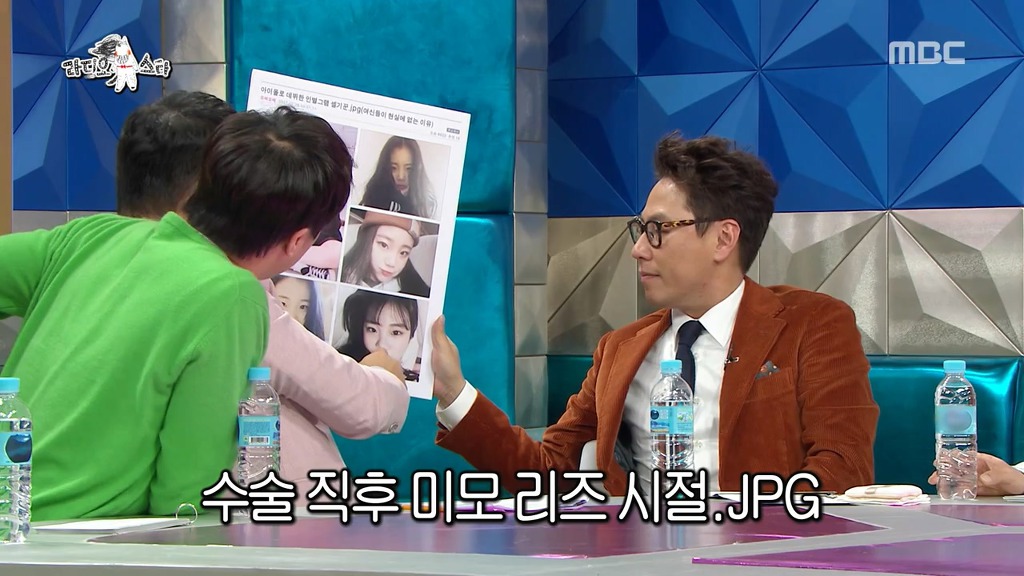 [라디오스타] 코수술 사실을 소속사에 숨겼다가 딱 걸린 주이.jpgif | 인스티즈